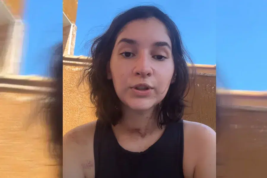 Jovem esfaqueada 15 vezes pede justiça e convoca manifestação; audiência inicial será dia 15 6 Alana Anísio Rosa, 20 anos, grava vídeo usando regata preta, cabelos escuros, cicatrizes visíveis nos braços e colo