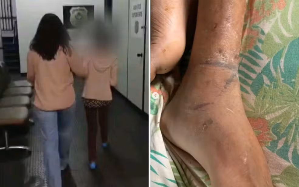 Mãe investigada por manter filho acorrentado sem água e comida em Goiás; vítima sobreviveu a três AVCs 6 Mulher de costas sendo conduzida em delegacia de Goiás após prisão por maus-tratos ao filho. Tornozelos com marcas de contenção prolongada de vítima mantida acorrentada pela mãe